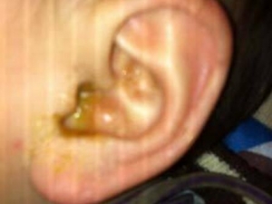 ж׵֢״ ж׳ʲôҩ ŧж