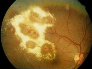 �۵׻ư߲�֢״ �۵׻ư߲���Ԥ��