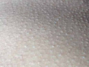 �����м�Ƥ������ô�� ��Ƥ�����ʲôˮ����