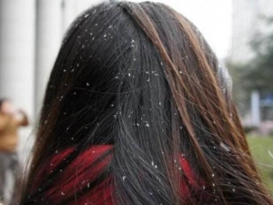 ���Ԥ��ͷƤм���� ͷƤм�������ʳ����