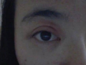 ��Ƥ������ô�� ���Ԥ����Ƥ���� ��Ƥ���׳�ʲôʳ���