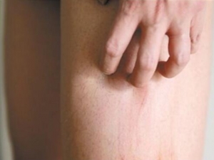 򲡵֢״ 򲡵ʳԭ 򲡳ʲô