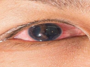 Ĥײ˵ʳԭ Ĥ׻ߵע Ĥ׻߳ʲô