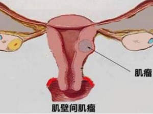 ����Ů���������ӹ����� �ӹ�������ô��