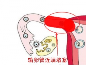 ���ѹܶ���������ô�� ���Ԥ�����ѹܶ��� ��������λ���