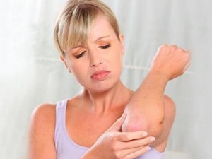 Ƥ��������ԭ�� �＾���Ԥ��Ƥ������