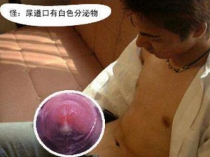 ��������׵����� ��������׵�����ƫ��