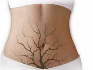 ���ڶ��ضѻ����ź� �����Ч�Ŷ�