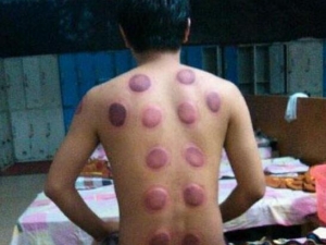 �ι޺�Ƥ����ɫ���� �ι޺��ע������