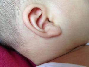 ����������Ⱦ��֢״ ����������Ⱦ��ô��