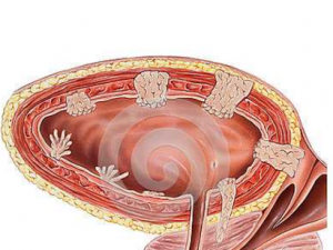 ������_�����ߵĹ�Ч����|��������