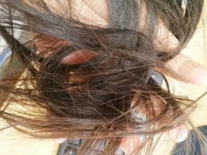 �����ѷ�������ô�� Ԥ�������ķ����Ƽ�