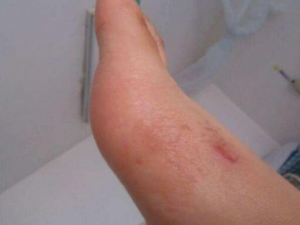 ʪ����ô�� ʪ���ʲô��