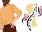 腰痹的症状 腰痹如何治疗 腰痹的注意事项