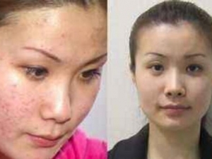 ���ﶬ������������� �𶻴�����ȫ