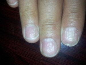 ��ָ�װ�͹��ƽ��Σ�� ���Ԥ����ָ�װ�͹��ƽ