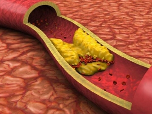 ѪƤʲô ѪƤΣ ѪƤķ