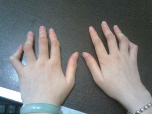 ʪԹؽ׵֢״ ԤʪԹؽ