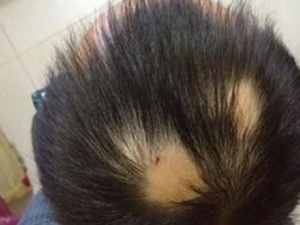 �շ���ͺ��ԭ�� ��ͺ��ô�� ��ͺ��ʲô��