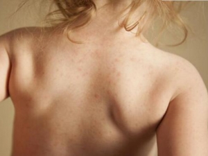 ҩ�������ô�� ҩ��������Ԥ��