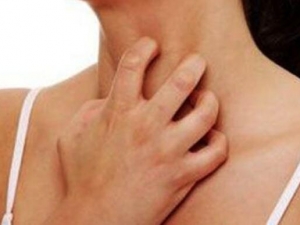 ������ʪ���֢״ ������ʪ�����Ԥ�� ������ʪ����ô��