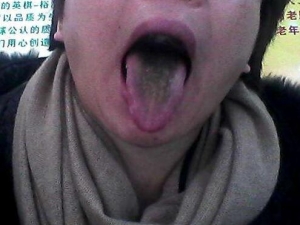 ��̦�ڵ�ԭ�� ��̦����ô�� ��̦����ε���