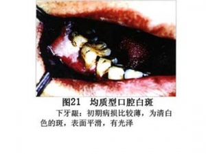 ��ǻ�װ���ʲô ��ǻ�װߵ�֢״