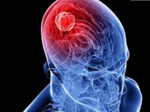 �Խ������ֲ������Ԥ���Խ�����