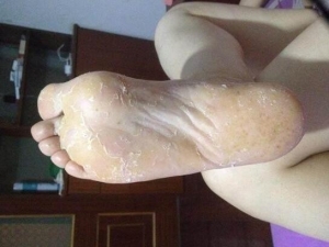 ������ô�졡������ҽ����ô���ƽ����ģ�