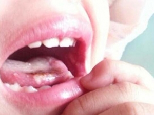 ��ǻ������ô�� ��ǻ�����ܳ�ʲô