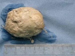 �����ӵĹ�Ч������ �����ӵ��÷�����