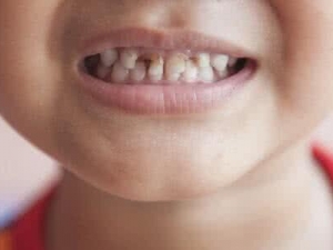 ����������ԭ�� ����������ô��