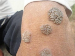 ʲô�������� ��������γ�ԭ��