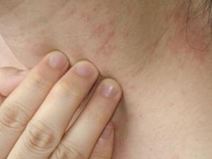 ʪ��Ƥ�������ԭ�� ʪ��Ƥ���������Ƶķ���