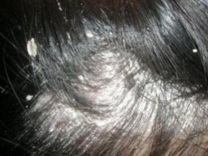 ͷƤм���ԭ�� ͷƤм����ô��