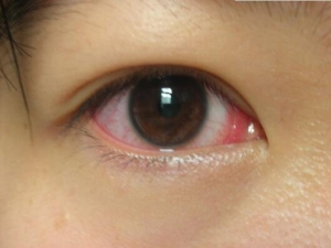 Ϊʲô���ǵ��۾��ᷢ�� ��λ����۾�����