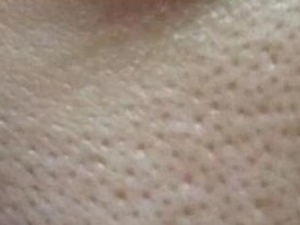 ë�״ִ���ô�� �������ë�׵�ƫ���Ƽ�