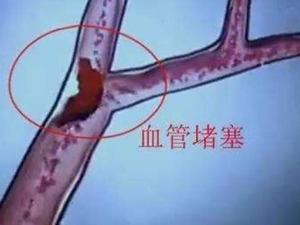 �����龹Ҳ��Ѫ�� Ѫ�ܶ�����ε���