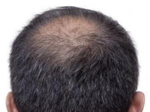 �ѷ���ԭ������Щ �ѷ���ô�� �ѷ���ʲô��