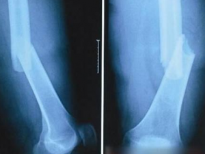 ���ۺ�������ʳ����Ҫע��ʲô��