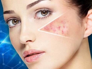 ��֪����ôȥ����ӡ�� ���㼸���ӡ�ķ���