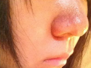 �����֢״��������Щ�� Ԥ�����������Щ����