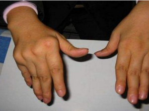 ���ʪ��Σ��������Щ���� ���ʪ���ߵ���ʳ����