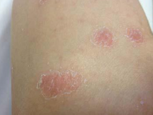 ��ҽ���ĵ����� ��ҽ��������ţƤѢ