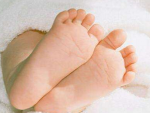 ���ƽ���Ƥ��ƫ�� ����Ƥ��ʲô��