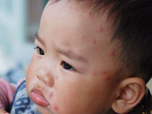 Ϊʲô��ˮ�� ����ˮ����ҽ��ô����