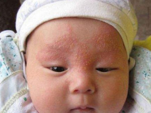 ��ҽ�������ʪ�� ��ҽ����ʪ�������