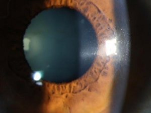 �����۽�Ĥ����ô�� ������ƽ�Ĥ��