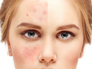 Ƥ�������ԭ�� ��λ���Ƥ������