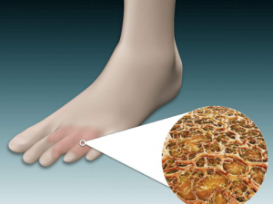 �̵����ƽ����İ˸�Сƫ��